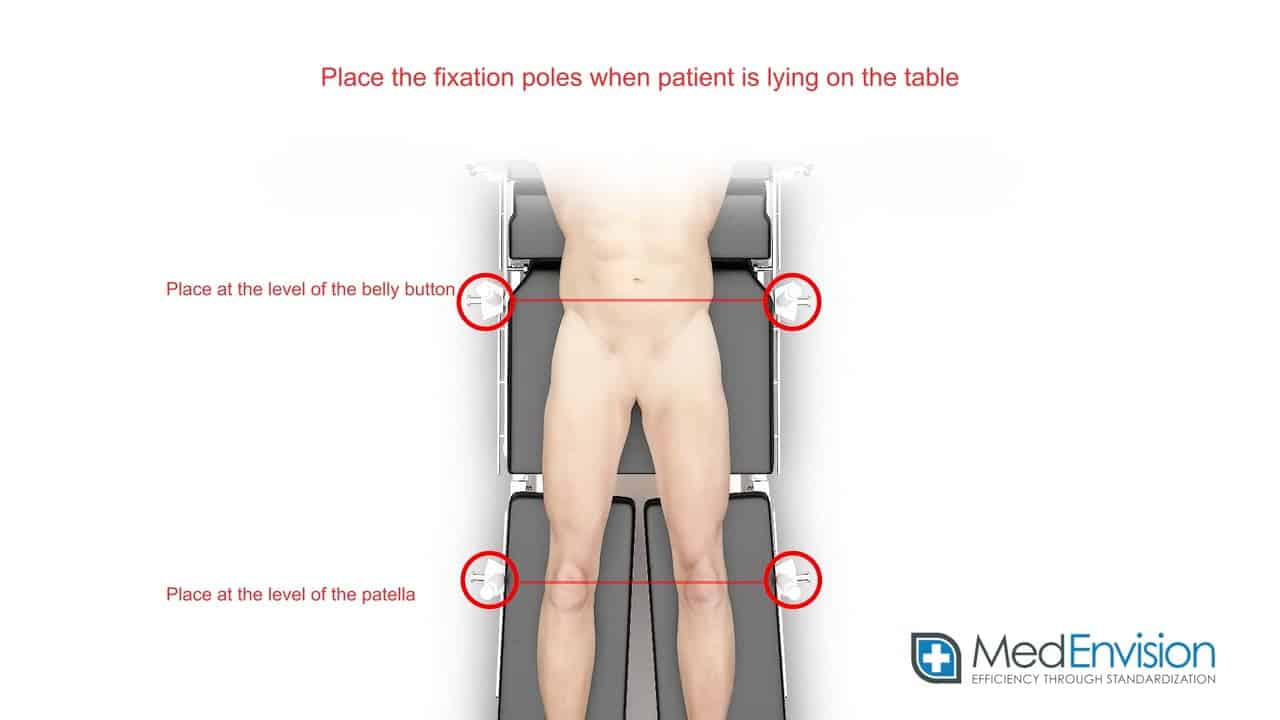 Total knee
